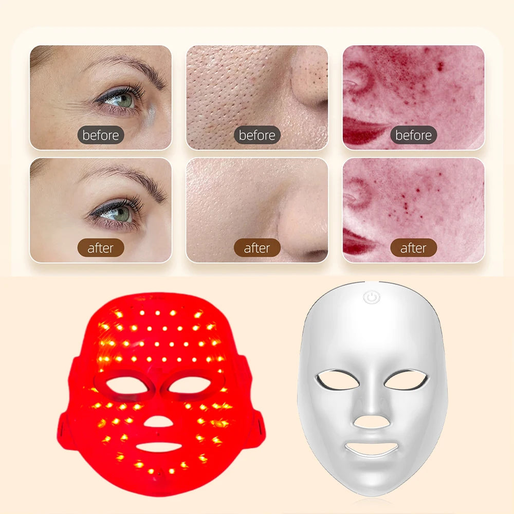 Máscara Facial LED 7 Colores | Terapia de Luz para el Cuidado de la Piel